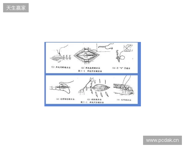 广州豹官方:杨浩眉弓伤口缝合30余针,预计5-7天后拆线 广州豹官方:杨浩眉弓伤口缝合30余针,预计5-7天后拆线